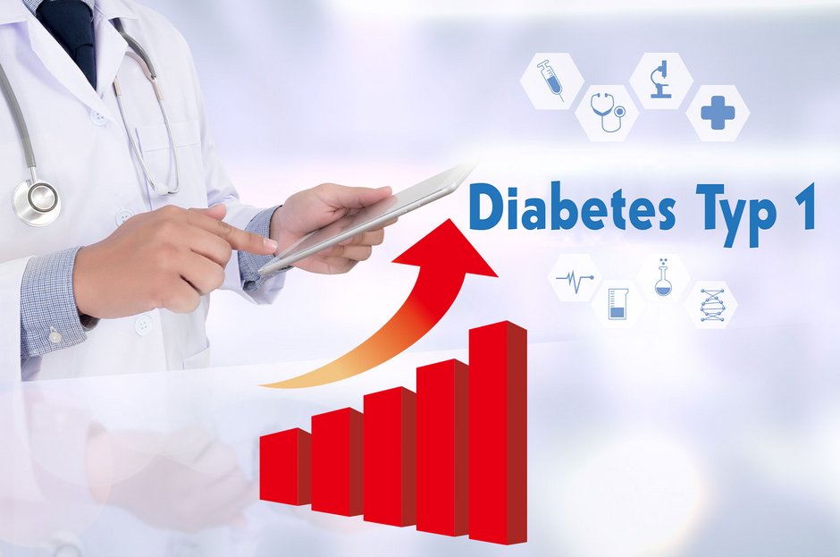 Weltweite Verdoppelung Von Diabetes Typ 1 Bis 2040 | Diabetiker ...